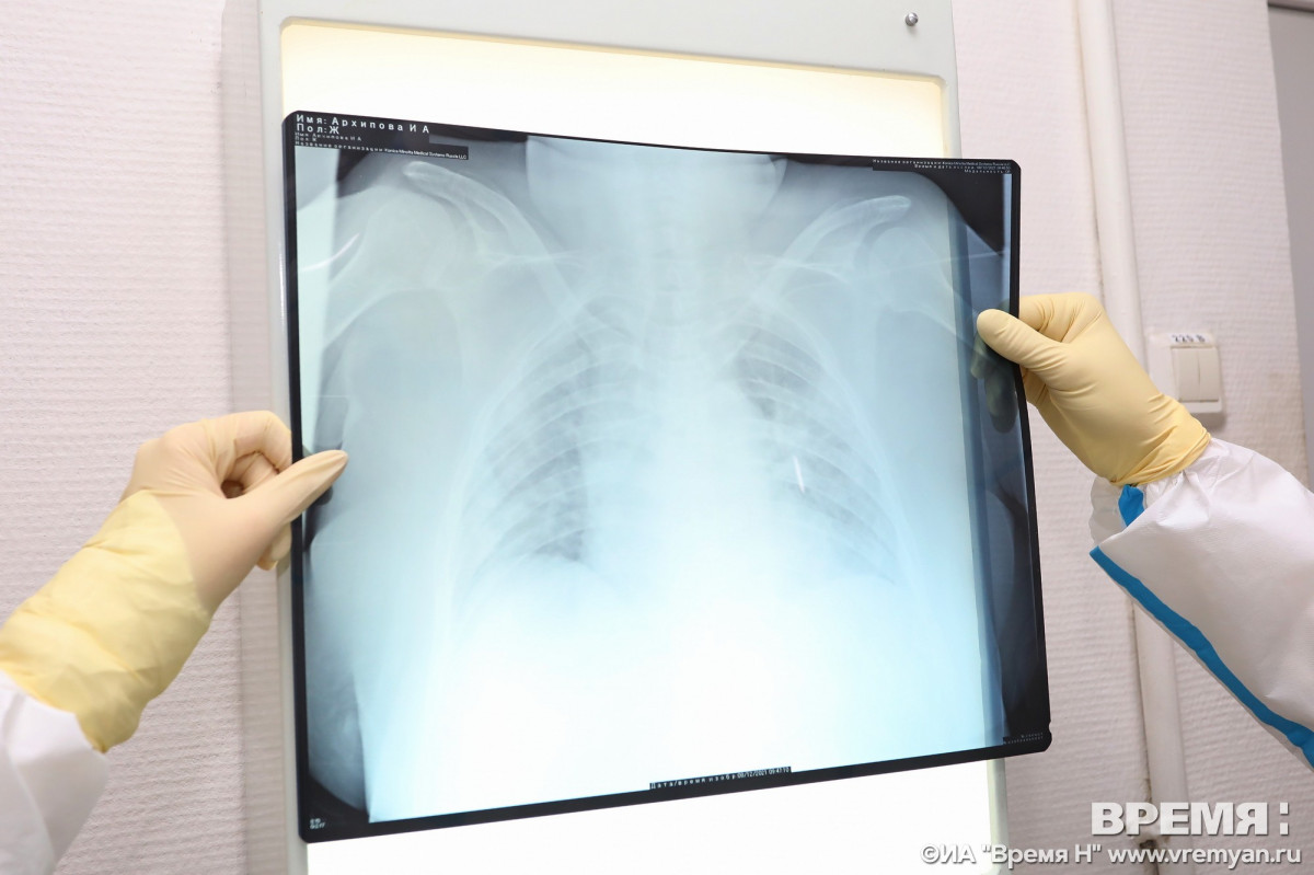 За год в Нижегородской области выявили 950 тысяч случаев заболеваний органов дыхания